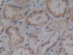 IFNAR2 Antibody in Immunohistochemistry (Paraffin) (IHC (P))