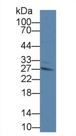 IFNAR2 Antibody in Western Blot (WB)