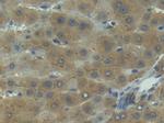 IL1R1 Antibody in Immunohistochemistry (Paraffin) (IHC (P))