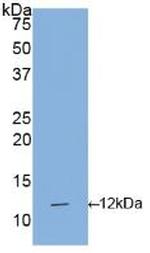 IL1R1 Antibody in Western Blot (WB)