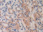 IL11RA Antibody in Immunohistochemistry (Paraffin) (IHC (P))