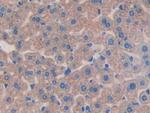 IL11RA Antibody in Immunohistochemistry (Paraffin) (IHC (P))