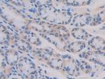 IL11RA Antibody in Immunohistochemistry (Paraffin) (IHC (P))