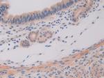 IL11RA Antibody in Immunohistochemistry (Paraffin) (IHC (P))