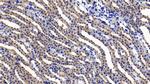 IL11RA Antibody in Immunohistochemistry (Paraffin) (IHC (P))