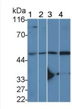 IL11RA Antibody in Western Blot (WB)