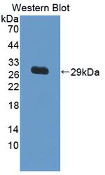 IL17RC Antibody in Western Blot (WB)