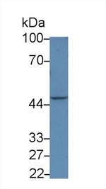 IL31RA Antibody in Western Blot (WB)