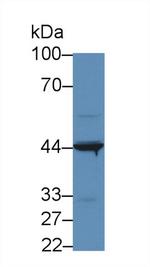 IL31RA Antibody in Western Blot (WB)