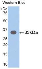 IL31RA Antibody in Western Blot (WB)