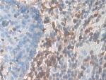 CD127 Antibody in Immunohistochemistry (Paraffin) (IHC (P))