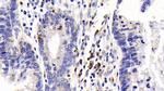 CD127 Antibody in Immunohistochemistry (Paraffin) (IHC (P))