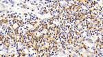 CD127 Antibody in Immunohistochemistry (Paraffin) (IHC (P))