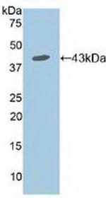 CD127 Antibody in Western Blot (WB)