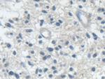 IARS Antibody in Immunohistochemistry (Paraffin) (IHC (P))