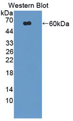 IARS Antibody in Western Blot (WB)