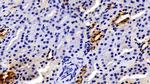 JAK2 Antibody in Immunohistochemistry (Paraffin) (IHC (P))