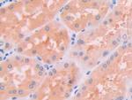 JAK2 Antibody in Immunohistochemistry (Paraffin) (IHC (P))