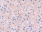 JAK2 Antibody in Immunohistochemistry (Paraffin) (IHC (P))