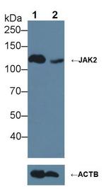 JAK2 Antibody in Western Blot (WB)