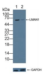 LMAN1 Antibody in Western Blot (WB)