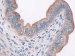 LEPR Antibody in Immunohistochemistry (Paraffin) (IHC (P))