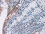 LEPR Antibody in Immunohistochemistry (Paraffin) (IHC (P))