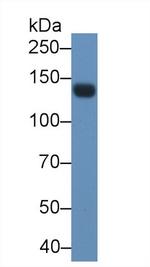 LEPR Antibody in Western Blot (WB)