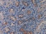 LSR Antibody in Immunohistochemistry (Paraffin) (IHC (P))