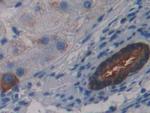 LSR Antibody in Immunohistochemistry (Paraffin) (IHC (P))