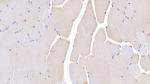 LSR Antibody in Immunohistochemistry (Paraffin) (IHC (P))