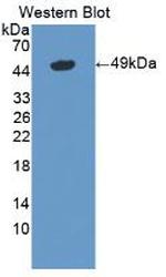 LSR Antibody in Western Blot (WB)