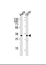 SNAIL Antibody in Western Blot (WB)