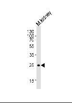 SNAIL Antibody in Western Blot (WB)