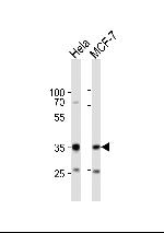 SNAIL Antibody in Western Blot (WB)