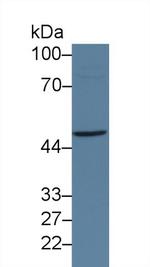 JMJD2A Antibody in Western Blot (WB)