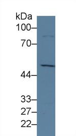 JMJD2A Antibody in Western Blot (WB)