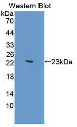 JMJD2A Antibody in Western Blot (WB)