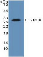 KARS Antibody in Western Blot (WB)