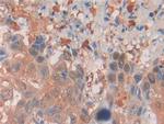 MIF Antibody in Immunohistochemistry (Paraffin) (IHC (P))