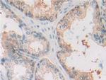 MIF Antibody in Immunohistochemistry (Paraffin) (IHC (P))