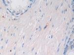 HLA-C Antibody in Immunohistochemistry (Paraffin) (IHC (P))