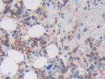 HLA-C Antibody in Immunohistochemistry (Paraffin) (IHC (P))