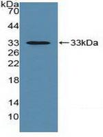 HLA-C Antibody in Western Blot (WB)