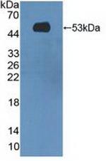 MASP1 Antibody in Western Blot (WB)