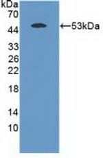 MASP1 Antibody in Western Blot (WB)