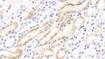 MMP13 Antibody in Immunohistochemistry (Paraffin) (IHC (P))