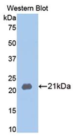 MMP13 Antibody in Western Blot (WB)