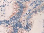 MMP24 Antibody in Immunohistochemistry (Paraffin) (IHC (P))