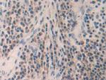 MMP24 Antibody in Immunohistochemistry (Paraffin) (IHC (P))